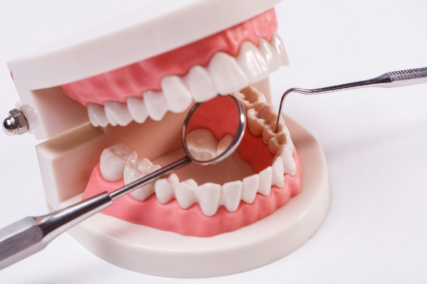 השיטה ליישור שיניים שאתם חייבים להכיר 